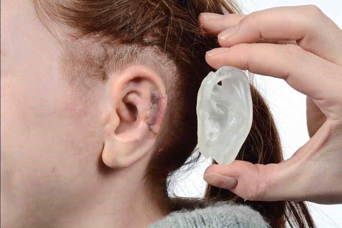 3D Scanning with Artec Spider for Healthcare